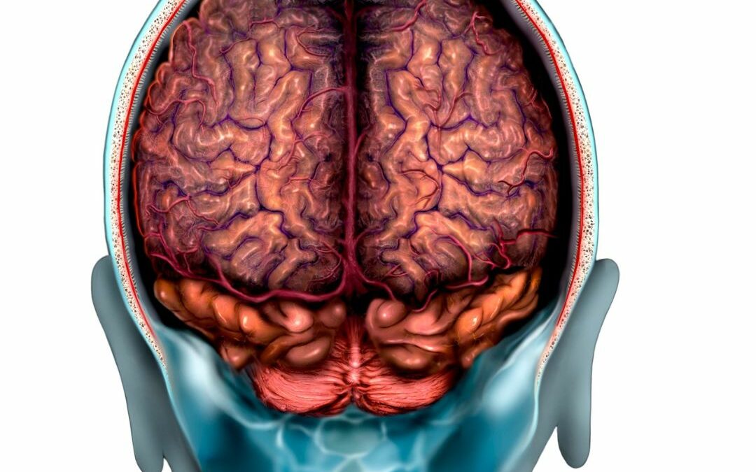 Everything You Need to Know About Meningiomas