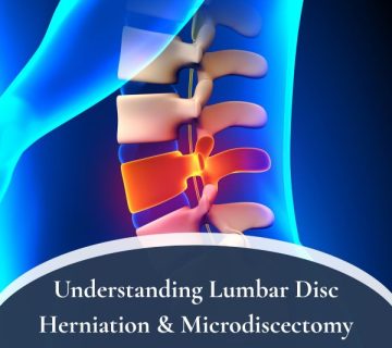 Lumbar Disc Herniation 360x320