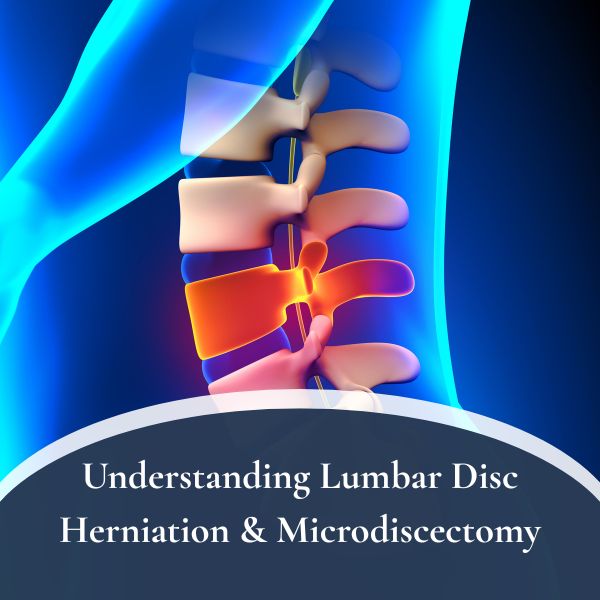 Lumbar Disc Herniation