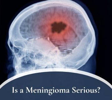 Is a Meningioma Serious 360x320