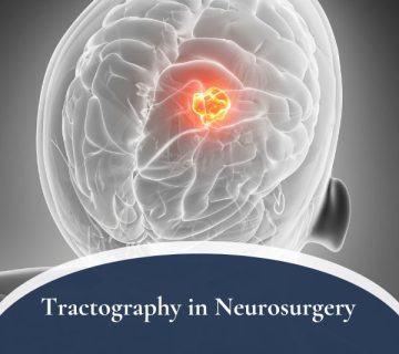 Tractography in Neurosurgery 360x320