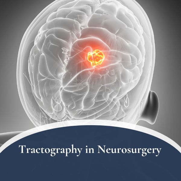 Tractography in Neurosurgery