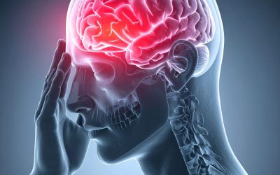 Subdural Hematoma in Older Adults
