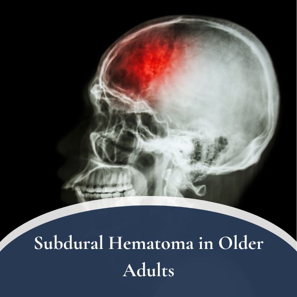 Subdural Hematoma in Older Adults