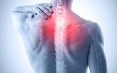 Back Pain vs. Pinched Nerve
