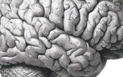White Matter Changes on Your MRI: What They Mean, and What They Don’t