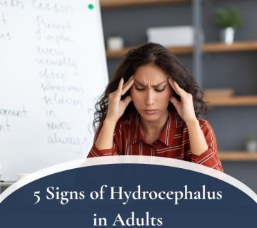 5 Signs of Hydrocephalus in Adults 360x320