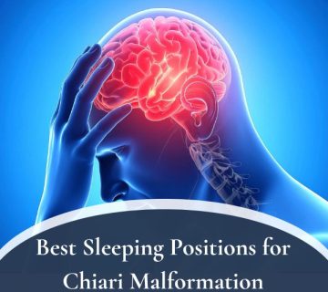 Best Sleeping Positions for Chiari Malformation