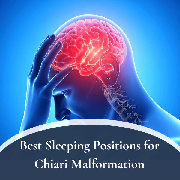 Best Sleeping Positions for Chiari Malformation