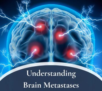 Brain Metastases 360x320