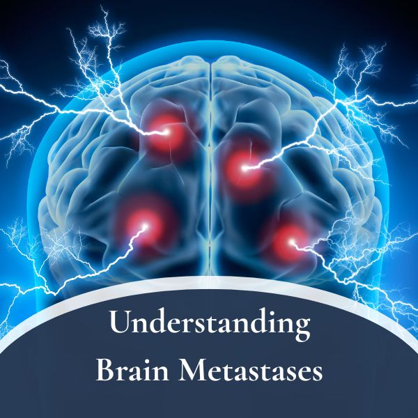 Brain Metastases