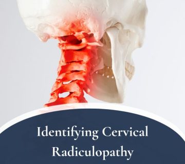Cervical Radiculopathy 360x320