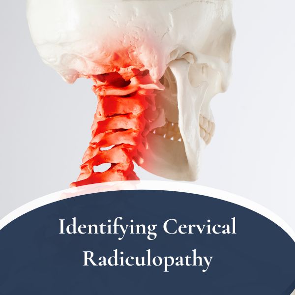 Cervical Radiculopathy