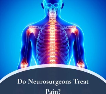 Do Neurosurgeons Treat Pain 360x320