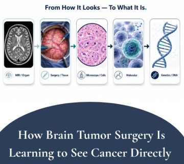 How Brain Tumor Surgery Is Learning to See Cancer Directly 360x320