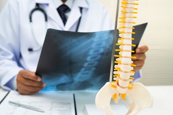 Laminectomy & Decompression