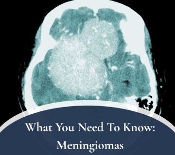 Meningiomas 360x320