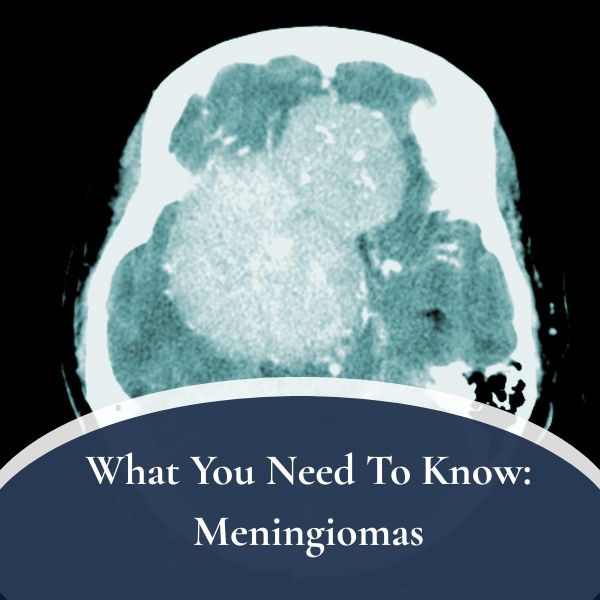 Meningiomas