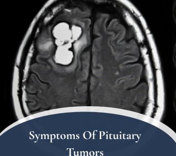 Symptoms Of Pituitary Tumors 1 360x320