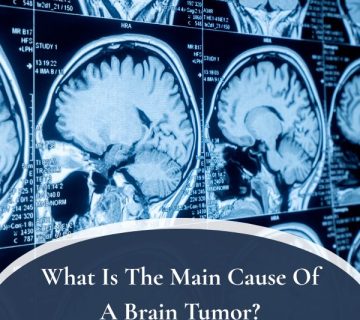 What Is The Main Cause Of A Brain Tumor 360x320