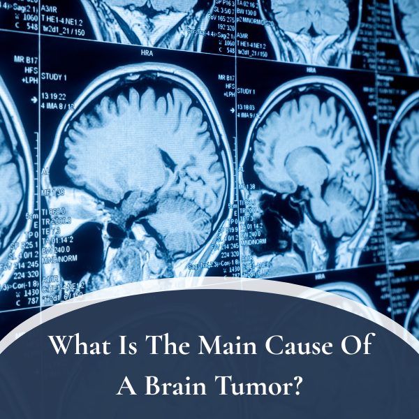 What Is The Main Cause Of A Brain Tumor