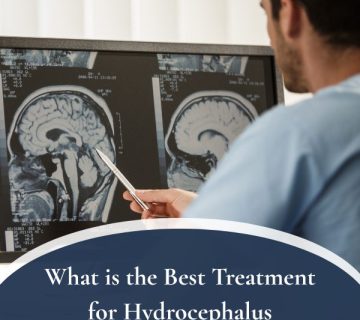 What is the Best Treatment for Hydrocephalus 360x320