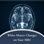 White Matter Changes on Your MRI 150x150