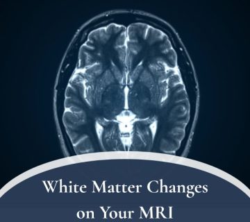 White Matter Changes on Your MRI 360x320