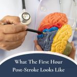 Post stroke 150x150