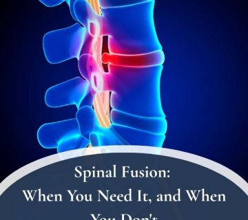 What A Neurosurgeon Can Do For Chronic Pain 1 360x320