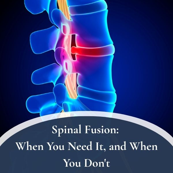 What A Neurosurgeon Can Do For Chronic Pain 1